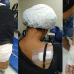 Homem esfaqueia mulher 14 vezes e só para depois da faca quebrar 