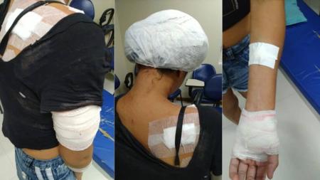 Mulher foi esfaqueada 14 vezes pelo companheiro