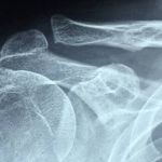 Mulher chamada de bêbada após cair em festa ganha indenização