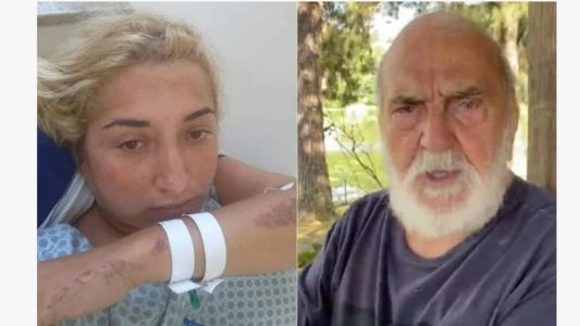 Mulher identificada como Simone quebrou cinco ossos da bacia