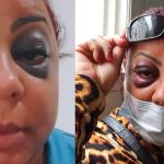Mulher perde 60% da visão após ser agredida pelo companheiro na frente do filho na Grande BH