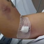 Diretor do hospital que amputou mão de mulher presta depoimento; advogada questiona unidade que 'cometeu absurdos' 