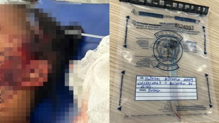 Na primeira imagem, foto distorcida da mulher ferida com a faca cravada na cabeça; na segunda imagem, a faca utilizada no crime