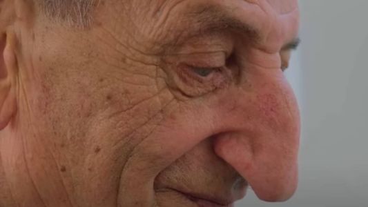 Nariz do turco Mehmet Özyürek mede 8,8 centímetros