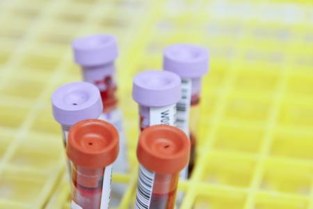 Mutirão da paternidade: instituto realiza exames de DNA gratuitamente todo fim de mês em SP | CNN Brasil
