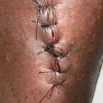 Nikão, do Cruzeiro, ironiza forte dividida com Igor Gomes no clássico: 'só amarelo'