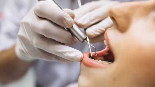Sucesso do implante dentário está relacionado à saúde bucal geral do paciente