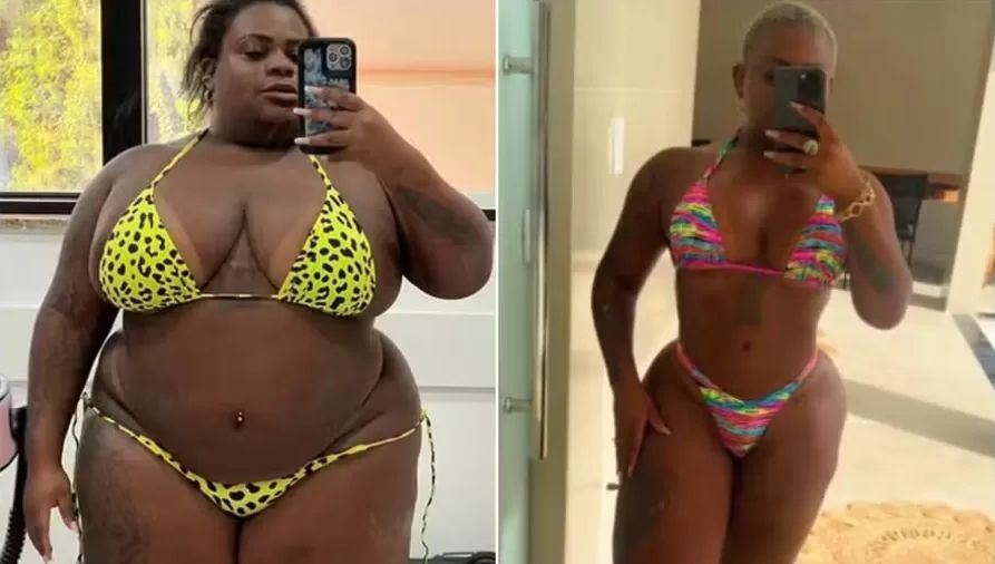 Jojo Todynho perde 74 kg com cirurgia bariátrica e exibe seu 'antes e depois'