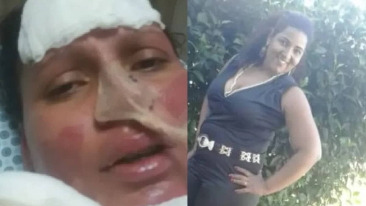 Mulher acorda de coma e grava vídeo denunciando marido por tentativa de feminicídio