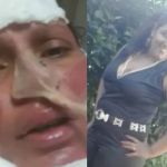 Mulher acorda de coma e grava vídeo denunciando marido por tentativa de feminicídio