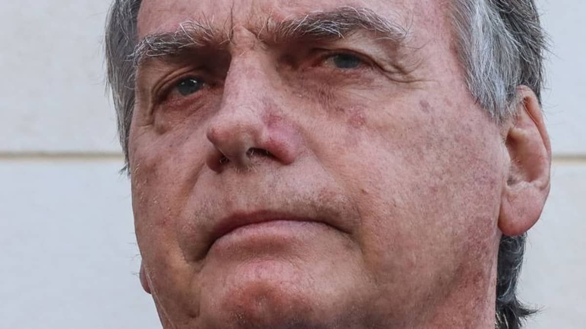 Bolsonaro tem melhora no quadro de saúde, mas segue sem previsão de alta