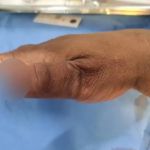 Jovem é presa por morder e arrancar pedaço de dedo de policial em Goiás