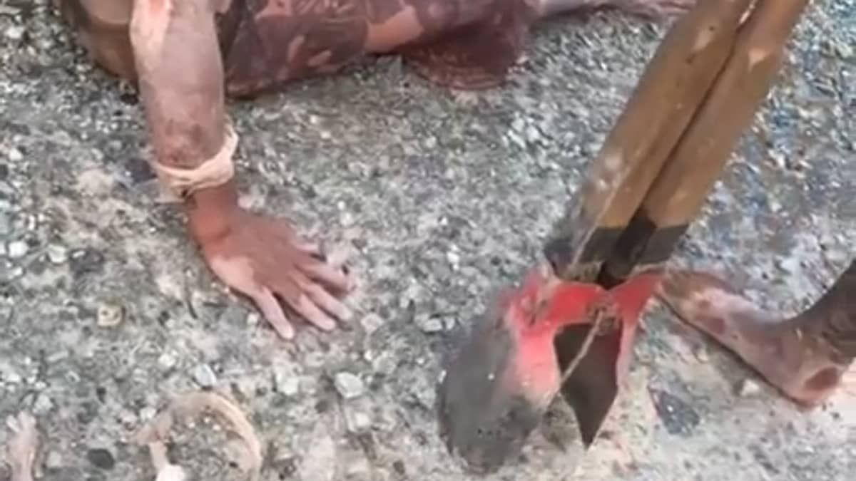 Suspeitos de torturar homem com 'boca de lobo' são presos em Contagem