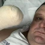Humorista tem mão amputada após sofrer acidente com fogos de artifício