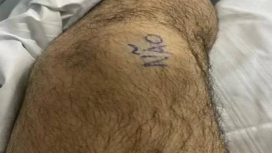 O joelho que deveria passar pela cirurgia foi identificado com um 'sim', e o que não seria operado foi identificado com um 'não'