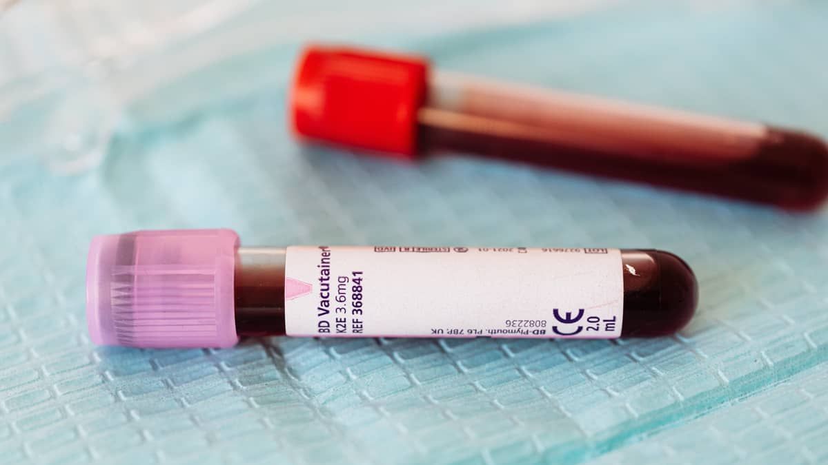 Tratamento reduz em 74% chance de câncer no sangue