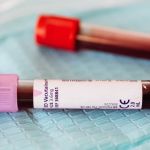 Tratamento reduz em 74% chance de câncer no sangue