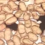 PF prende seis nigerianos com mais de 200 cápsulas de cocaína no estômago