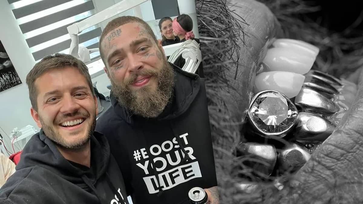 Rapper Post Malone lustra diamante no dente antes de show no 'The Town' 