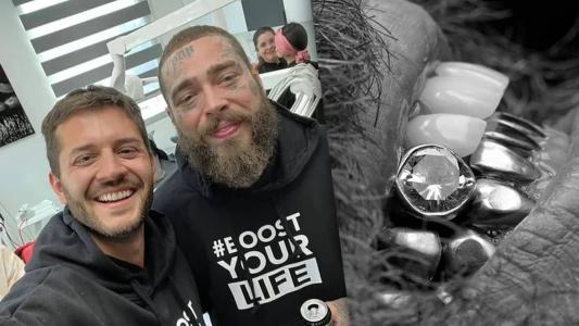 O rapper Post Malone fez questão de divulgar o momento em que foi ao dentista lustrar o seu dente de diamante