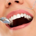 O que são Implantes Dentários e quais os seus benefícios 