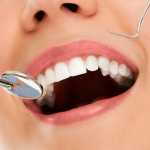 O que são Implantes Dentários e quais os seus benefícios