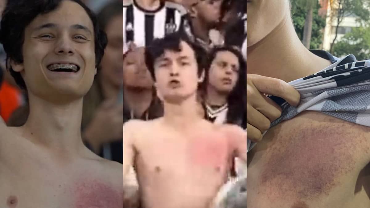 'Atleticano roxo': conheça torcedor que viralizou ao dar tapas no peito em jogo