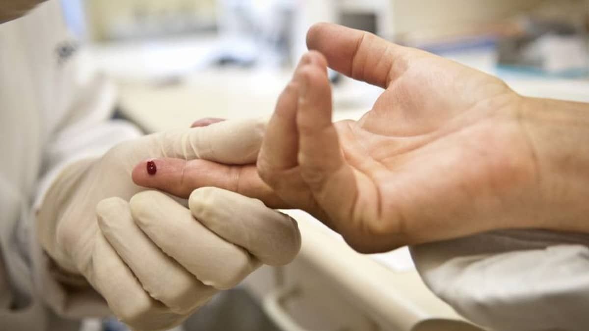 É possível acabar com epidemia de Aids até 2030, mostra estudo