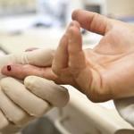 É possível acabar com epidemia de Aids até 2030, mostra estudo