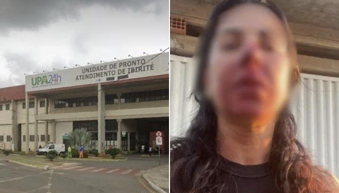 Oficial de Justiça agredida por PM teve hemorragia e náuseas