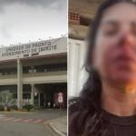 Oficial de Justiça agredida por PM teve hemorragia e náuseas