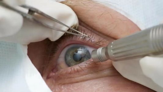 Foto mostra olho sendo analisado por profissional médico