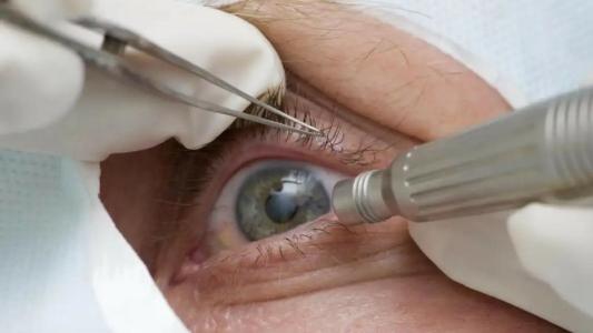 Foto mostra olho sendo analisado por profissional médico