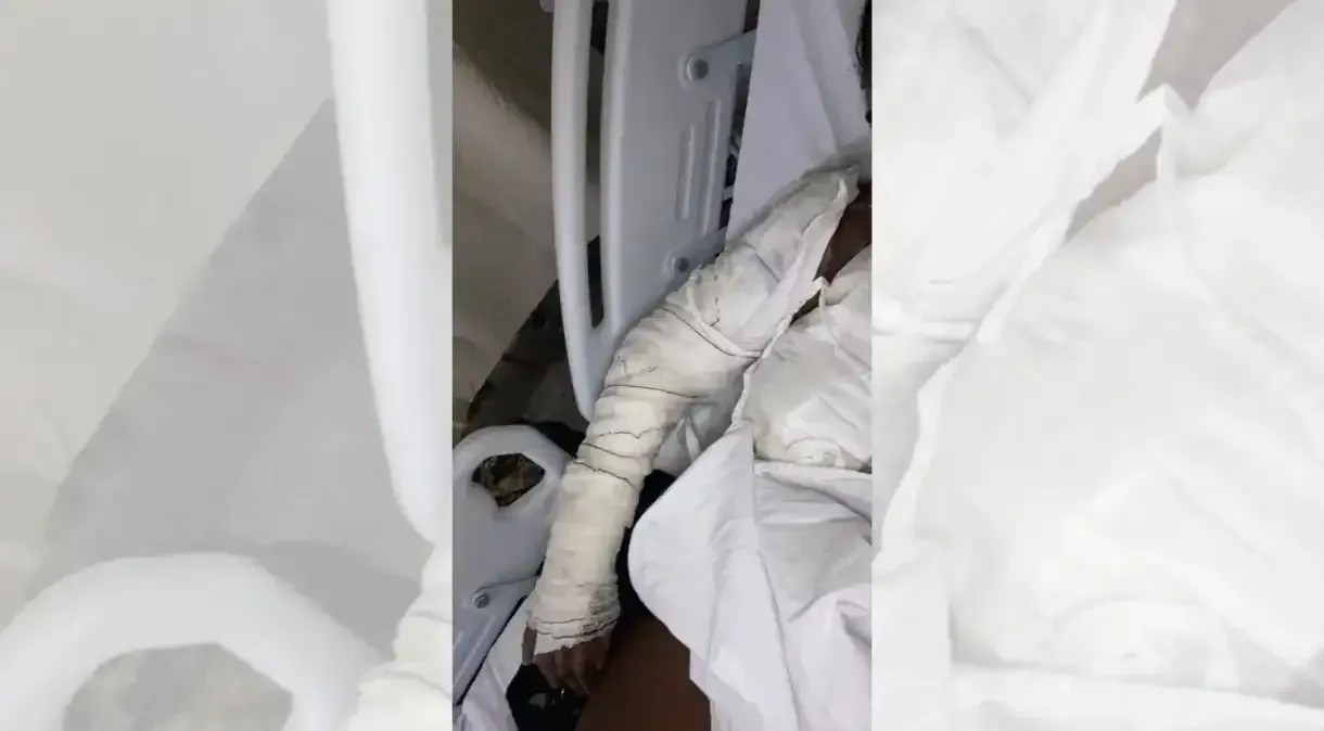 Mulher suspeita de traição e ataca jovem com facadas e oito litros de óleo quente no RJ