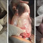 Nascimento de trigêmeos de gestação natural emociona médicos e enfermeiros em BH; veja fotos