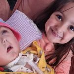 Família mineira de gêmea siamesa luta para custear tratamento e faz vaquinha 