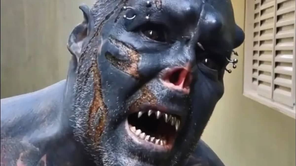 Homem com apelido de 'Caveira' queima rosto após mutilar orelha e nariz