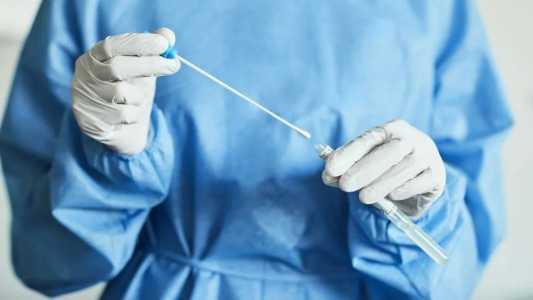 SP implanta teste rápido que detecta nova variante da Mpox | CNN Brasil