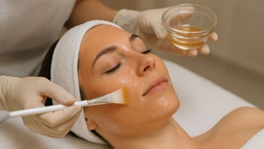 Peeling químico quando escolher esse tratamento em vez do de diamante