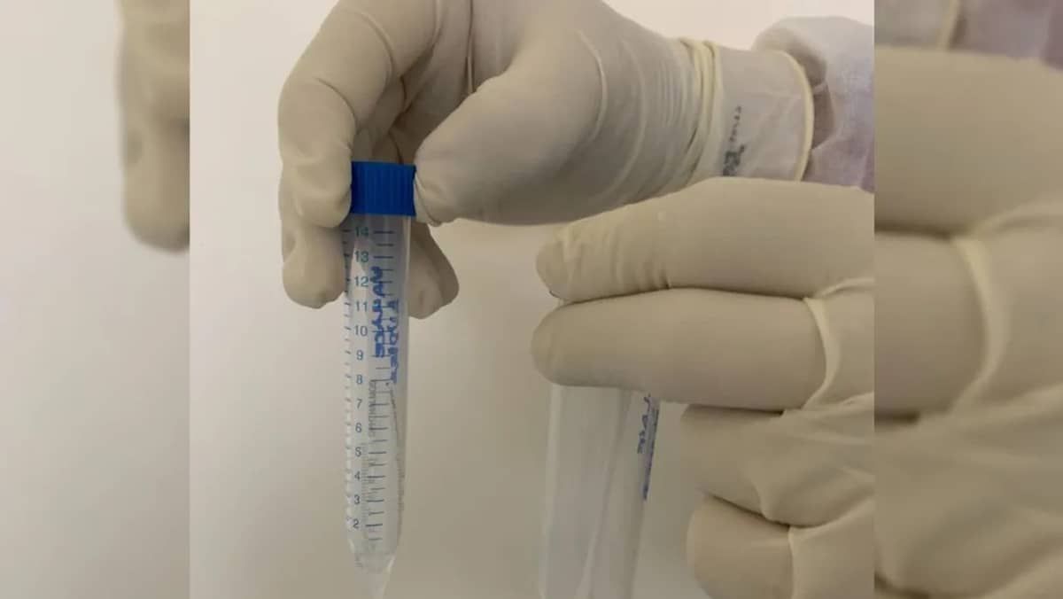 Estudo comprova a presença do vírus COVID-19 em lágrimas