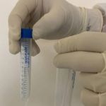 Estudo comprova a presença do vírus COVID-19 em lágrimas