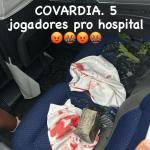 Ônibus do Fortaleza é atingido por bomba, e jogadores são levados ao hospital