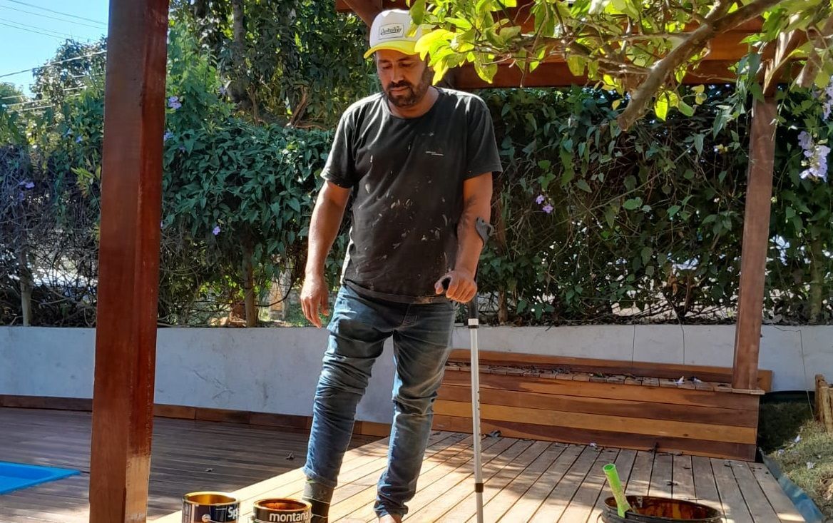 Pintor que aguarda cirurgia há anos em BH trabalha de muletas e teme perder a perna