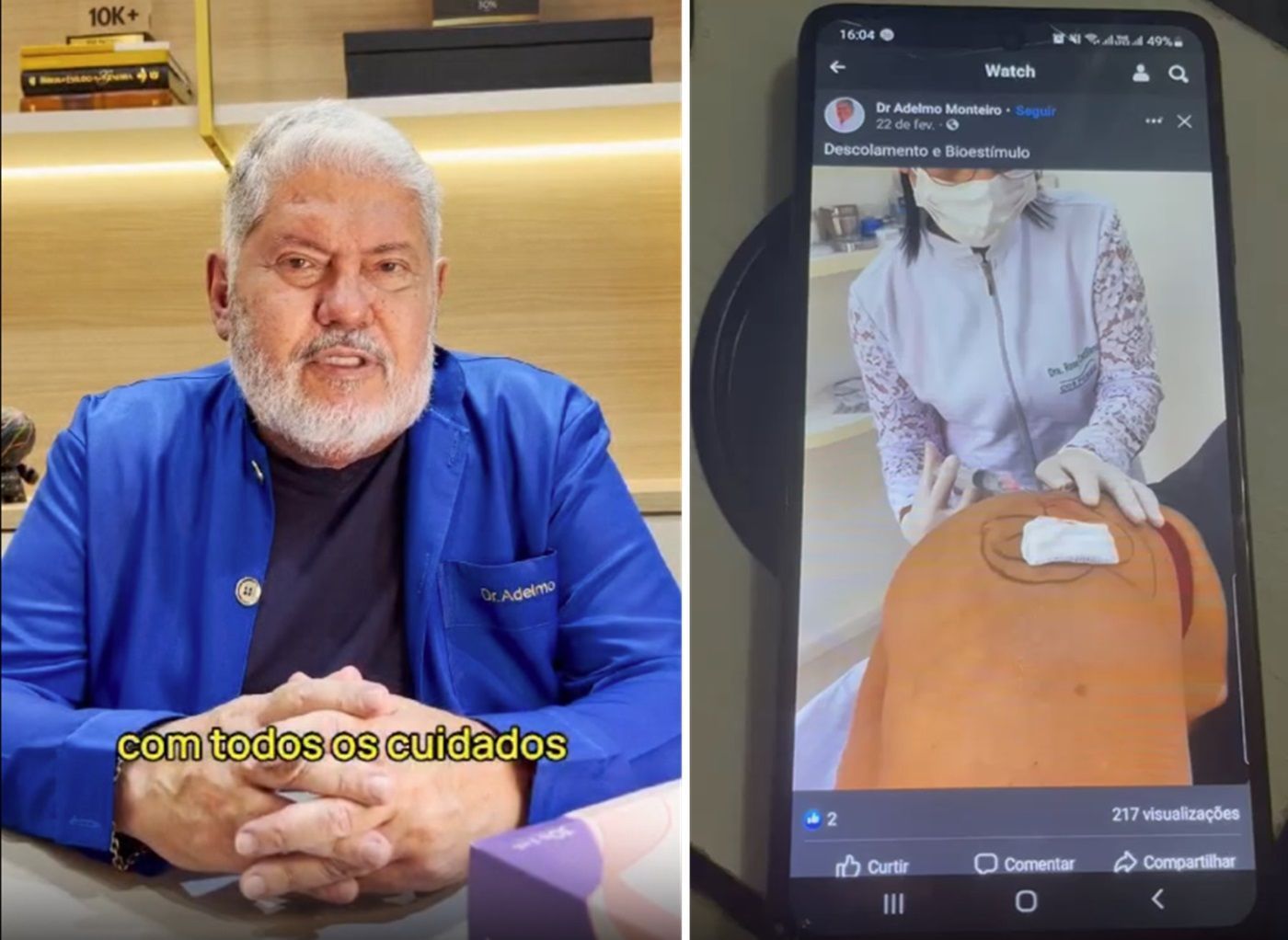 Médico que aplicou PMMA junto com dentista alertava nas redes: 'cirurgia só com médico'