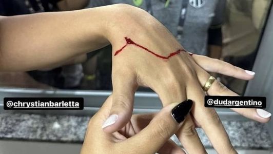 Post do atacante Saulo Mineiro mostra mulheres feridas após vidro quebrar em camarote