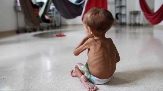 Povos Yanomami vivem tragédia humanitária na Amazônia brasileira
