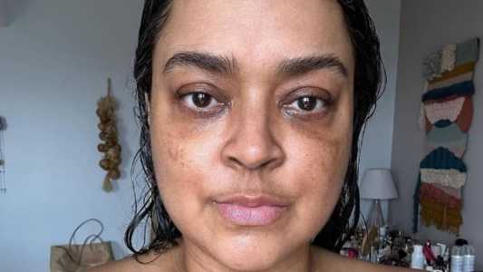 Preta Gil está em tratamento desde o dia 16 de janeiro