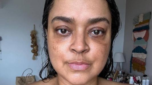 Preta Gil está em tratamento desde o dia 16 de janeiro