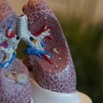 Tromboembolismo pulmonar: entenda as causas e os riscos do problema de saúde