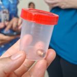 Raio-x mostra projétil no crânio de criança atingida por bala perdida no Ano-Novo, na Grande BH